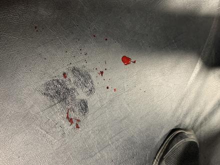 Ever squeeze someone's neck so hard that their nose squirts blood?!