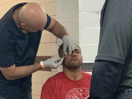 Josh Jones getting stitches after the fight