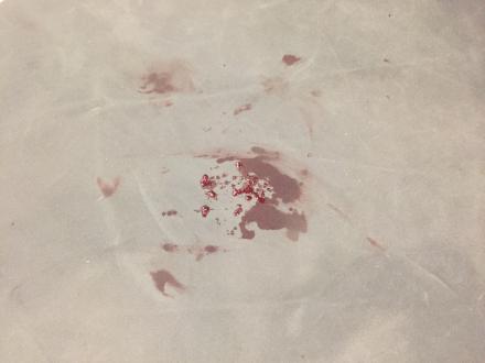 Gabe's blood post-fight